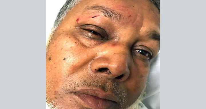 নিউইয়র্কে আবারও সন্ত্রাসী হামলার শিকার এক বাংলাদেশি