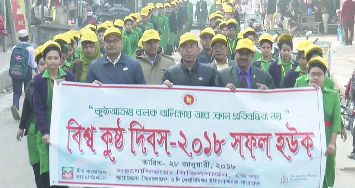 ভোলায় বিশ্ব কুষ্ঠ দিবস পালিত